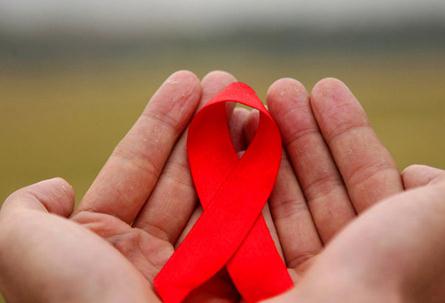 艾滋病怎么得的 艾滋病的发病原因介绍
